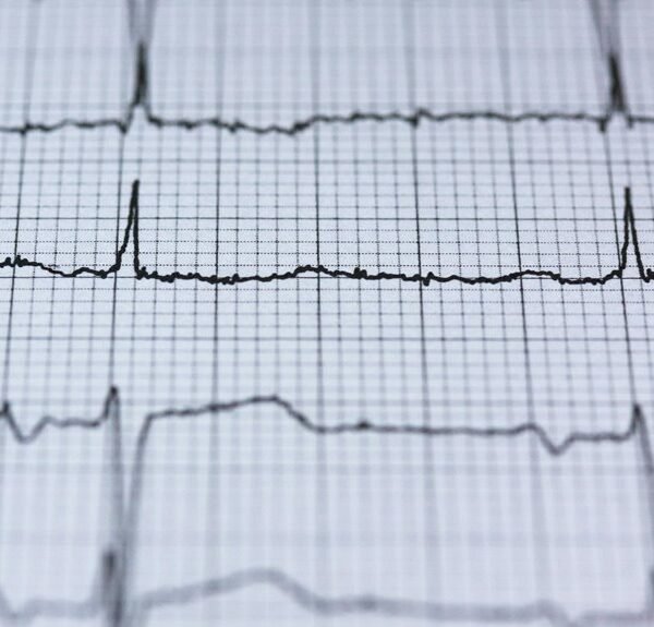 Hypernova Pulse 917906056 Revenue Orbit